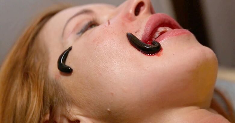 Leeches-ekin gaztetzea
